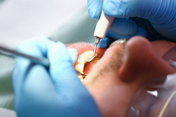 Best Pediatric Emergency Dentist in Scottdale, GA
