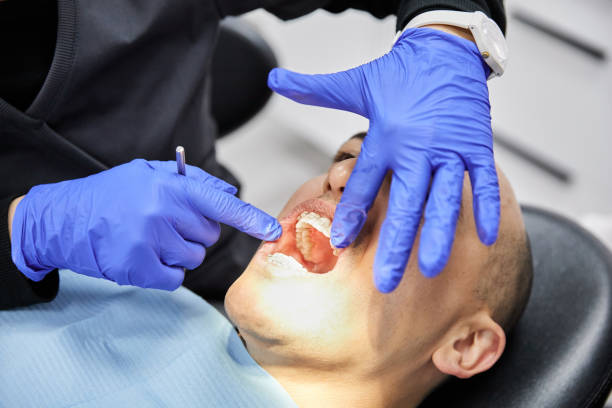 Best Emergency Dentist for Knocked-Out Tooth in Scottdale, GA
