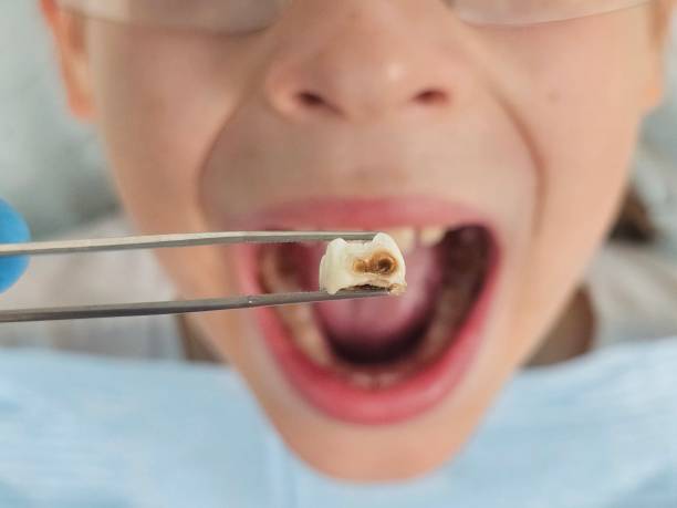 Best Weekend Emergency Dentist in Scottdale, GA